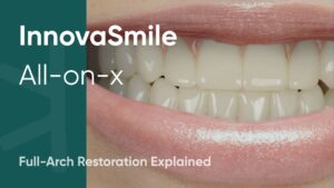 InnovaSmile: The Complete Guide to All-on-X Dental Implants