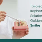Golden Isles Smiles: How Our Diverse Community Shapes Our Approach to Dental Implant Care