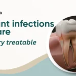 Can Dental Implants Get Infected? Here Is What You Should Know
