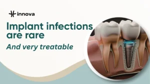 Can Dental Implants Get Infected? Here Is What You Should Know