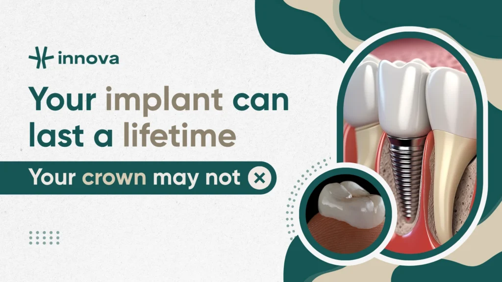 How Long Do Dental Implants Last? Lifespan, Factors, and What to Expect
