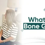 What Is a Bone Graft? How It Works, How Long It Takes to Heal, and What Patients Should Know
